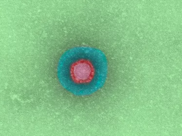 Fiches maladies - SRAS - Institut Pasteur