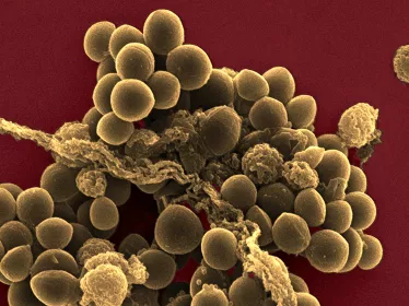 Fiches maladies - Staphylocoques - Institut Pasteur