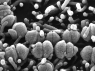 Fiches maladies - Streptocoques A et B - Institut Pasteur