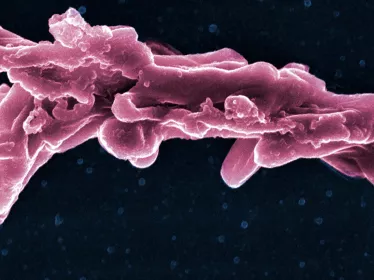 Fiches maladies - Tuberculose - Institut Pasteur