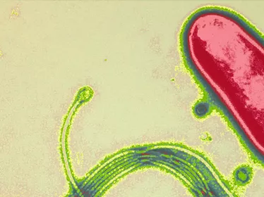 Fiche Maladie - Ulcères gastriques - Institut Pasteur