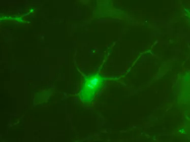 Fiches maladies - West Nile - Institut Pasteur