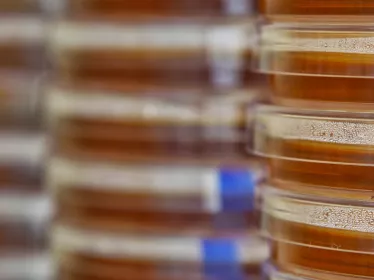Santé Publique - Centres nationaux de référence - Institut Pasteur