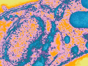 Santé Publique - CCOMS - Surveillance des résistances aux molécules antipaludiques - Institut Pasteur