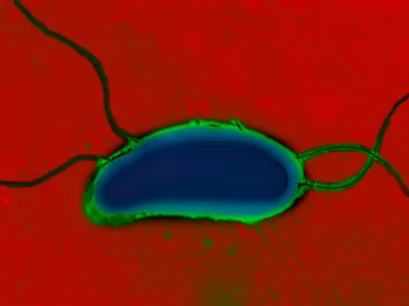 Vibrio cholerae - Institut Pasteur