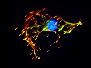 Listeria - Institut Pasteur