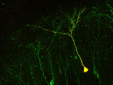 Néo-neurones dans un cerveau adulte - Institut Pasteur