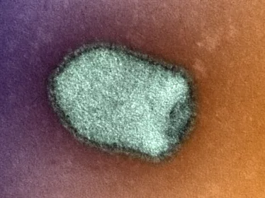 Virus rage - Institut Pasteur