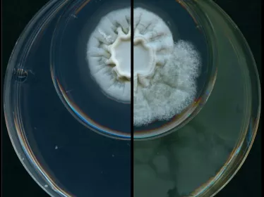 Aspergillus - Pseudomonas - Institut Pasteur