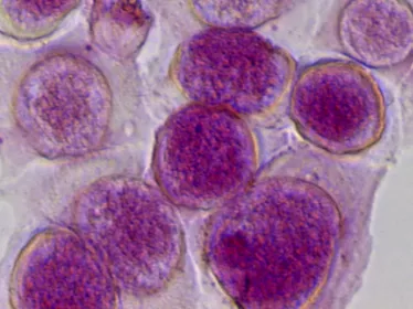 Chlamydia trachomatis - Institut Pasteur