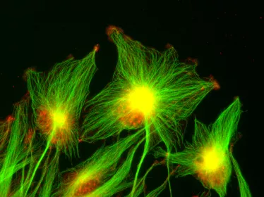 gliomes polarisation - Institut Pasteur