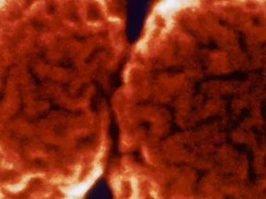 Santé Publique - CCOMS - Méningite - Institut Pasteur