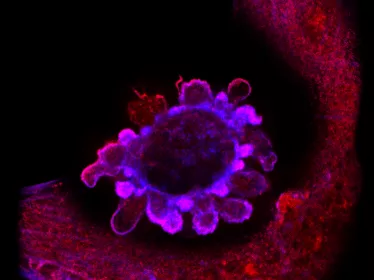 Journal de la Recherche - Une mort au service de l’immunité