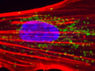 New therapies for brain disorders - Institut Pasteur