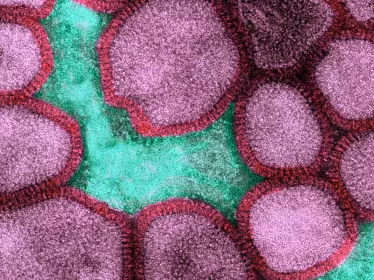 Fiches maladies - Grippe et Grippe aviaire - Institut Pasteur