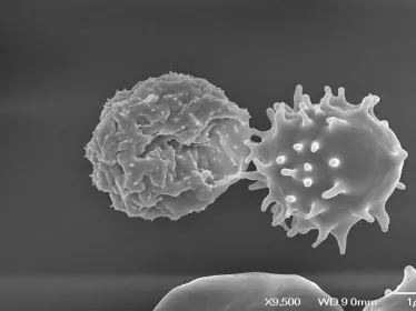 Globule rouge infecté par Plasmodium falciparum - © Institut Pasteur/Sylvie Perrot