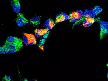 Comment le virus Zika induit la microcéphalie congénitale