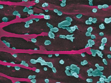 Cellules infectées - Institut Pasteur