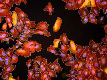 Listeria monocytogenes