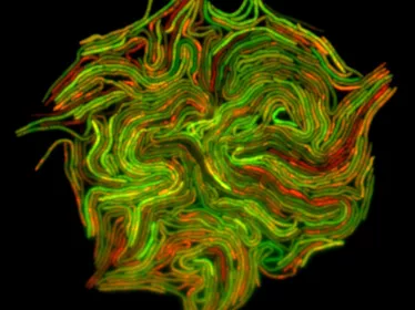 Mycobacterium - fluoresecence - Institut Pasteur