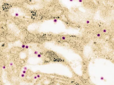 In-Cell-Art, l’Institut Pasteur et BioNet-Asia annoncent le développement en collaboration d’un candidat vaccin contre la dengue 