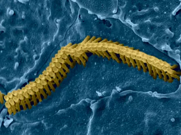Inner hair cell - audition - Institut Pasteur