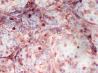 Fièvre jaune : nouvelle méthode pour tester l’innocuité du vaccin
