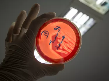 Streptococcus - Institut Pasteur