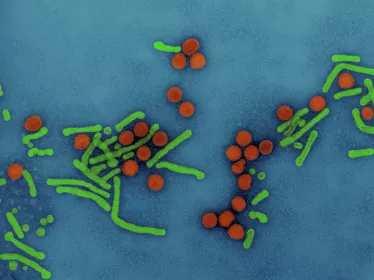 virus hépatite B - Institut Pasteur