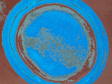 Clostridium tetani - Institut Pasteur