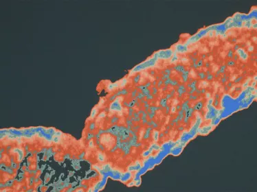 Coqueluche et autres bordetelloses - Institut Pasteur