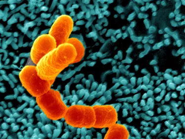 Escherichia coli, Shigella, Salmonella - Institut Pasteur