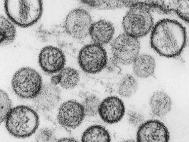 Hantavirus - Institut Pasteur