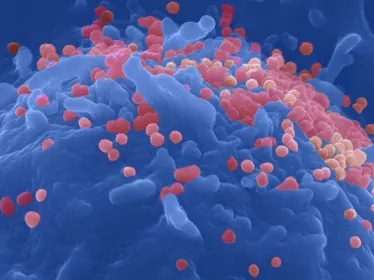 VIH CD4