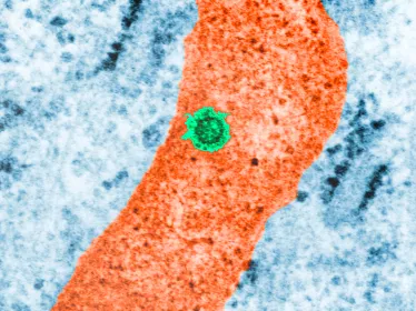 Fiches maladies - Dengue - Institut Pasteur