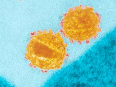 VIH : Identification de récepteurs clés de la réponse immunitaire chez les patients contrôlant spontanément l'infection - Institut Pasteur