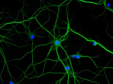 Comment la nicotine agit sur le cerveau des schizophrènes 