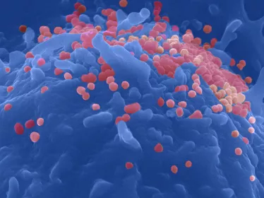 sida-vih
