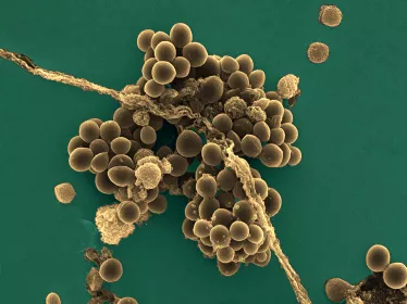 Staphylococcus aureus - Institut Pasteur