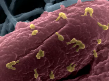 Bactériophages sur la bactérie Escherichia coli 