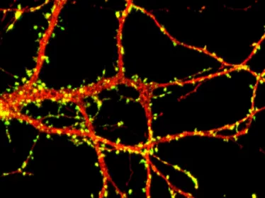 Microscopie d'un neurone.
