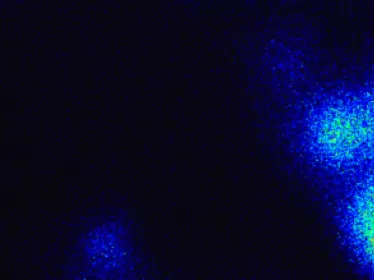 Population de macrophages infectés par le VIH