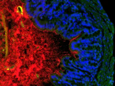 bactéries du colon. Comment le microbiote bloque les allergies