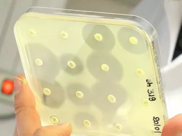 Face à l’antibiorésistance, une nouvelle arme tueuse de bactéries
