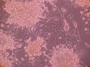 Cellules en culture infectées par le coronavirus MERS-CoV 