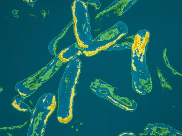 Pseudomonas aeruginosa, bactérie opportuniste, impliquée dans la mucoviscidose _ Institut Pasteur