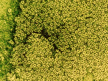 acetylcholine - Institut Pasteur