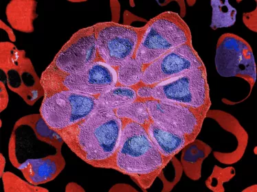 Mooc Malaria Institut Pasteur - Fun