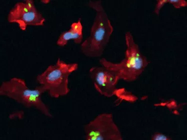 Macrophages infectés par M. tuberculosis (en vert), observés par microscopie confocale. © Réseau international des Instituts Pasteur