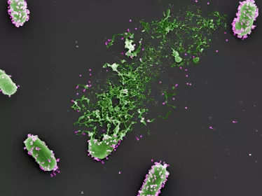 Phagothérapie et système immunitaire